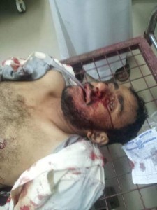 ردمان الوصابيشهيد الانفجار