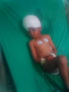 thumbnail_طفل اخر ضحايا من المصابين في القصف في منطقة جبل الشرق